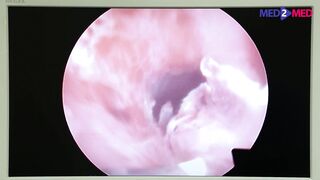 Gynecological medical films 44