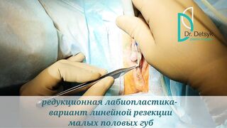 Gynecological medical films 45