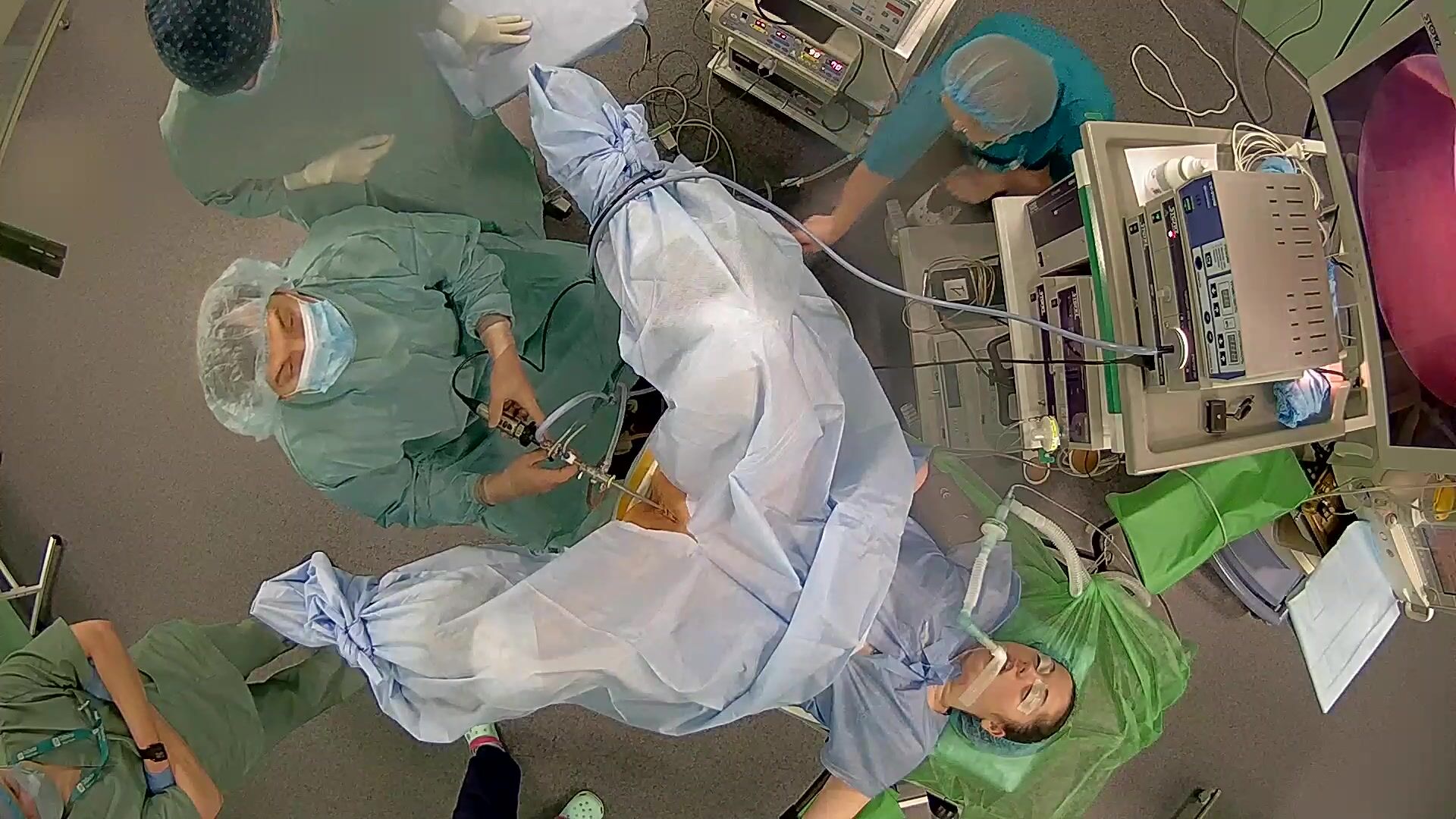 Gynecology operation 9